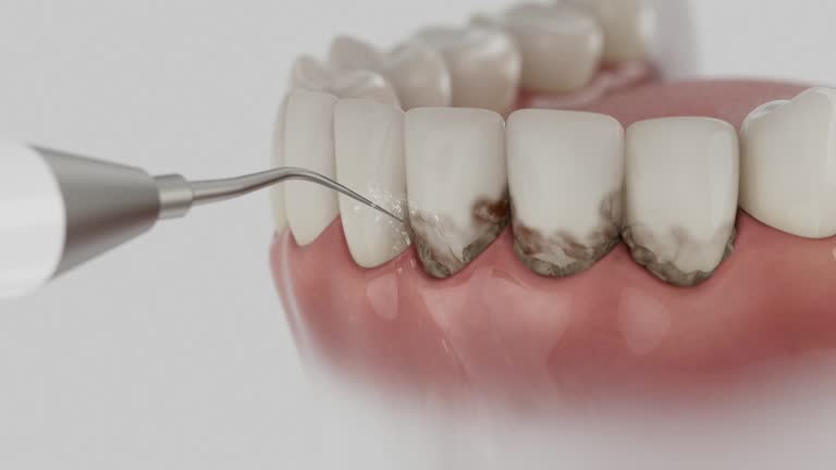 Trusted Root Canal Treatment service in Centerville, IN - Dentist Open Now